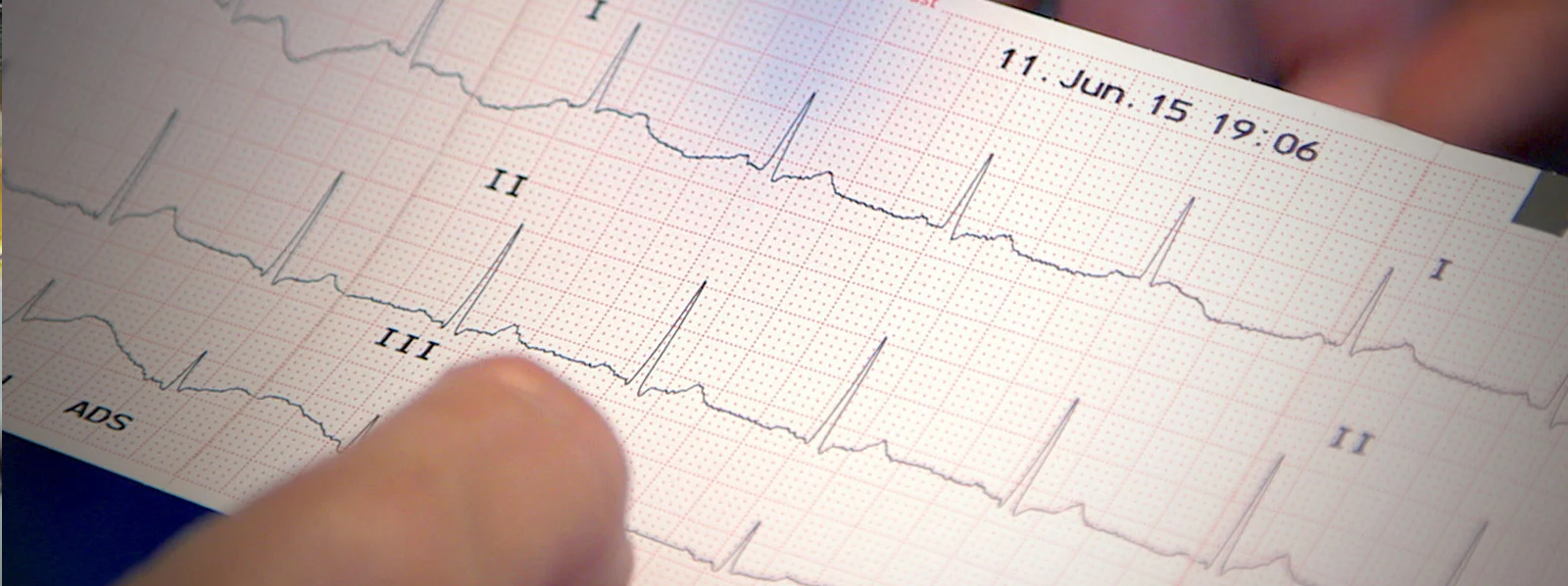 ECG Certification Dubai ECG Interpretation Courses ECG Certification Dubai ECG Interpretation Courses