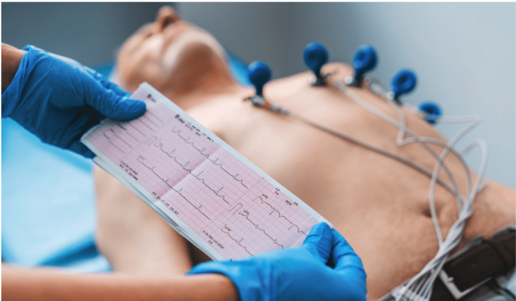 ECG