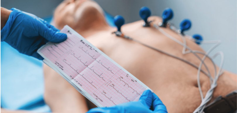 ECG
